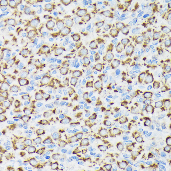 NDUFS4 Rabbit monoclonal antibody