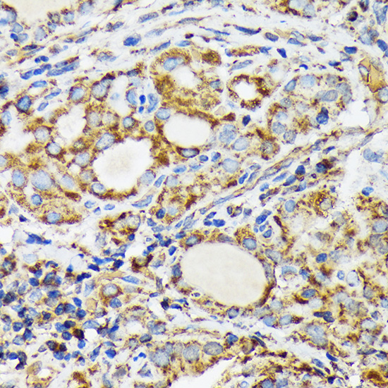 NDUFS4 Rabbit monoclonal antibody