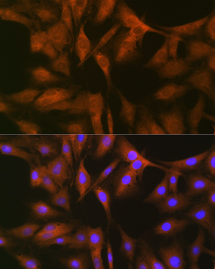 FXR1 Rabbit monoclonal antibody