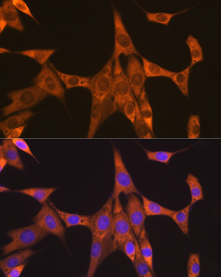 FXR1 Rabbit monoclonal antibody