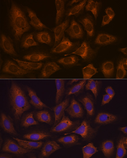 FXR1 Rabbit monoclonal antibody