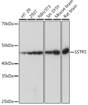 SSTR5 Rabbit monoclonal antibody