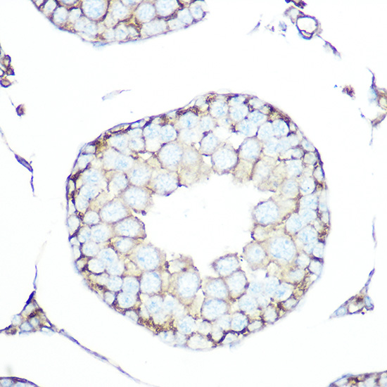 SSTR5 Rabbit monoclonal antibody