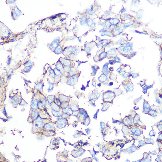 SSTR5 Rabbit monoclonal antibody