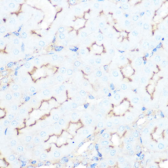 SSTR5 Rabbit monoclonal antibody