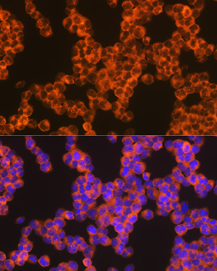 Oncostatin M Rabbit monoclonal antibody