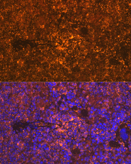 Oncostatin M Rabbit monoclonal antibody