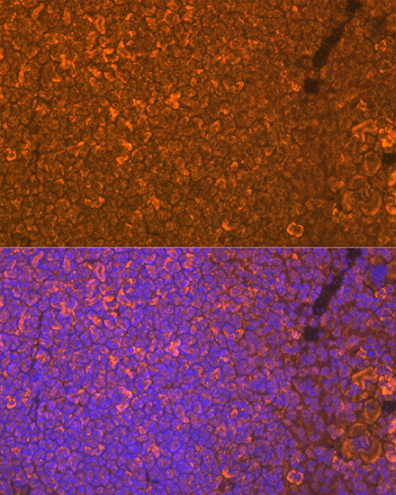Oncostatin M Rabbit monoclonal antibody