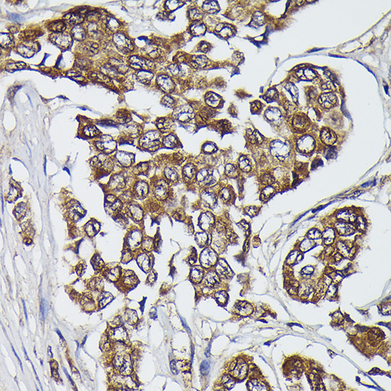 FERMT2 Rabbit polyclonal antibody