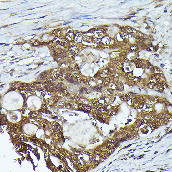 FERMT2 Rabbit polyclonal antibody