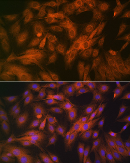 Calpain 1 Rabbit monoclonal antibody