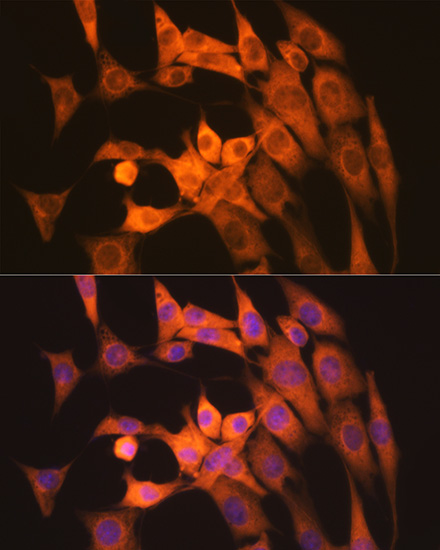 Calpain 1 Rabbit monoclonal antibody