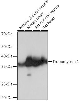 Tropomyosin 1 Rabbit monoclonal antibody