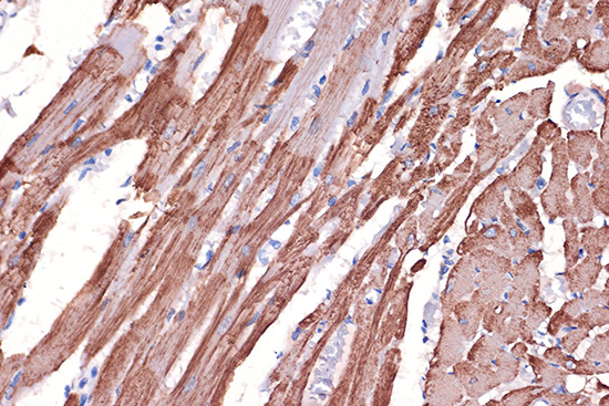 Tropomyosin 1 Rabbit monoclonal antibody