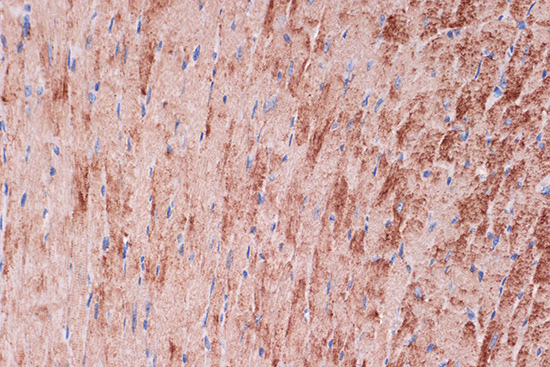 Tropomyosin 1 Rabbit monoclonal antibody