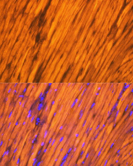 Tropomyosin 1 Rabbit monoclonal antibody