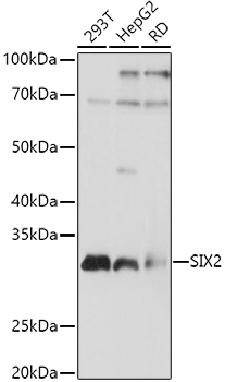 SIX2 Rabbit polyclonal antibody
