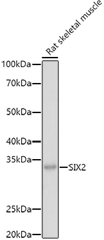 SIX2 Rabbit polyclonal antibody