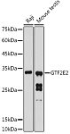 Western blot - GTF2E2 Rabbit pAb (A8732)