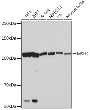 MSH2 Rabbit monoclonal antibody