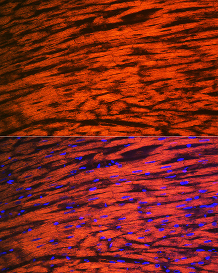 MYL2 Rabbit monoclonal antibody