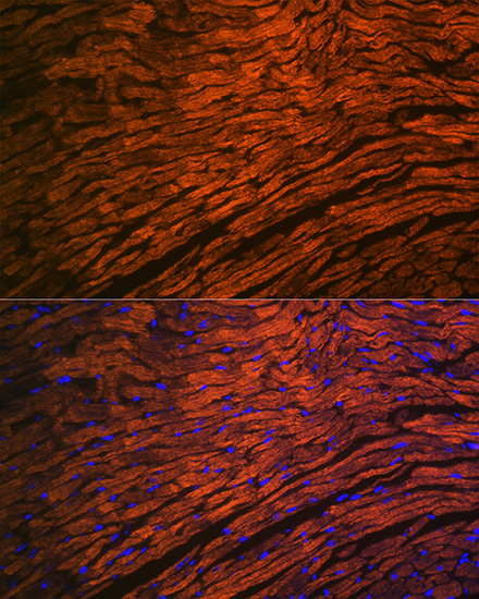 MYL2 Rabbit monoclonal antibody