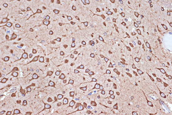 eEF1G Rabbit monoclonal antibody