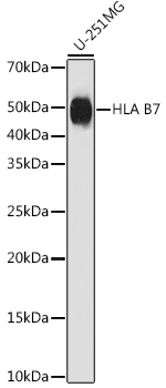 HLA B7 Rabbit monoclonal antibody