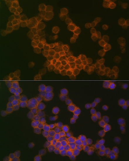 HLA B7 Rabbit monoclonal antibody