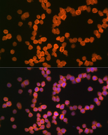 MHC class I (HLA-A/B) Rabbit monoclonal antibody