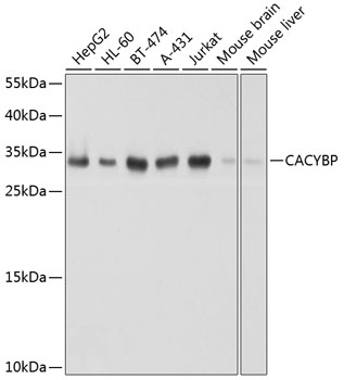 [KO Validated] CACYBP Rabbit polyclonal antibody