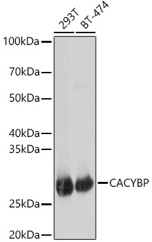 [KO Validated] CACYBP Rabbit polyclonal antibody