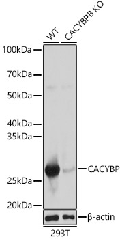 [KO Validated] CACYBP Rabbit polyclonal antibody