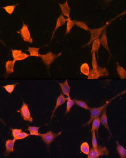 [KO Validated] CACYBP Rabbit polyclonal antibody
