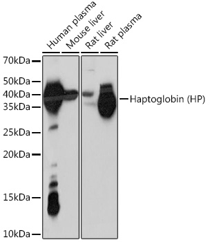 Western blot analysis of various lysates using Haptoglobin (HP) (HP) Rabbit mAb (A8778) at 1:1000 dilution.<br/>Secondary antibody: HRP-conjugated Goat anti-Rabbit IgG (H+L) (AS014) at 1:10000 dilution.<br/>Lysates/proteins: 25μg per lane.<br/>Blocking buffer: 3% nonfat dry milk in TBST.<br/>Detection: ECL Enhanced Kit (RM00021).<br/>Exposure time: 10s.