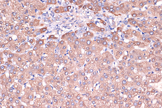 Haptoglobin (HP) Rabbit monoclonal antibody