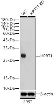 [KO Validated] HPRT1 Rabbit monoclonal antibody