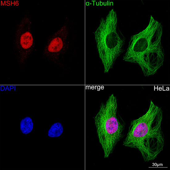 MSH6 Rabbit monoclonal antibody