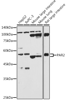 PAR2 Rabbit polyclonal antibody