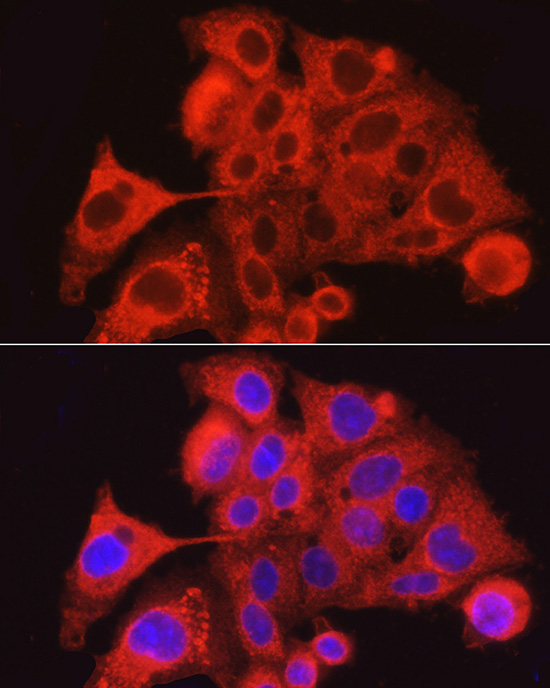PAR2 Rabbit polyclonal antibody