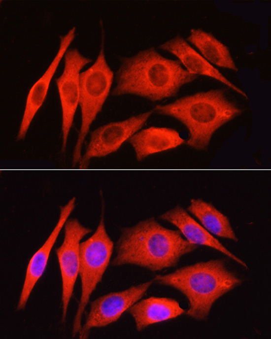 PAR2 Rabbit polyclonal antibody