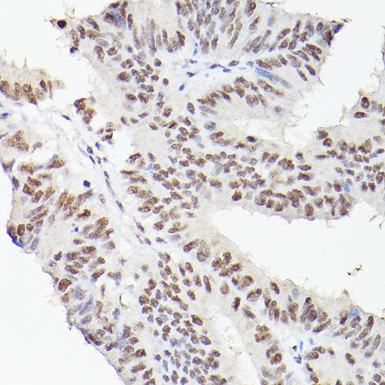 LEO1 Rabbit polyclonal antibody