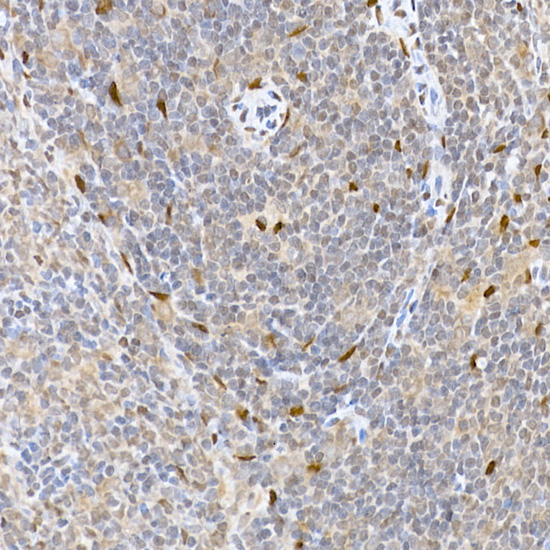 HDGFRP3 Rabbit polyclonal antibody