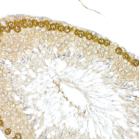 HDGFRP3 Rabbit polyclonal antibody