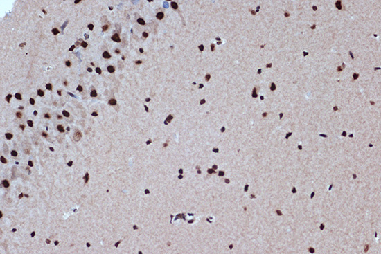 BUB3 Rabbit monoclonal antibody