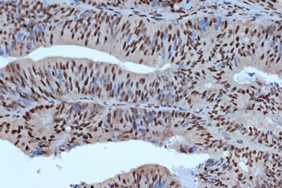 BUB3 Rabbit monoclonal antibody