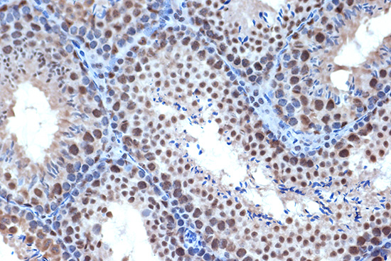 BUB3 Rabbit monoclonal antibody