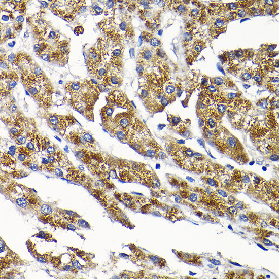 SCFD1 Rabbit polyclonal antibody