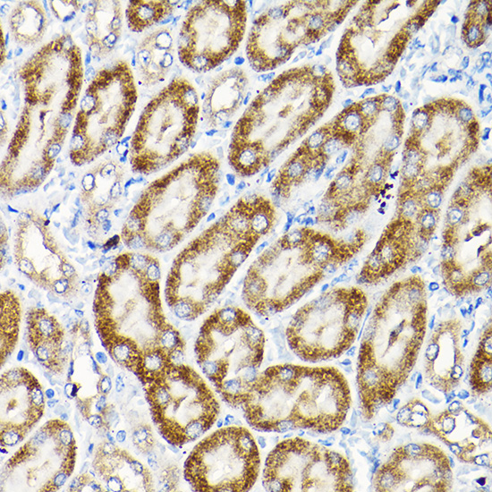 SCFD1 Rabbit polyclonal antibody