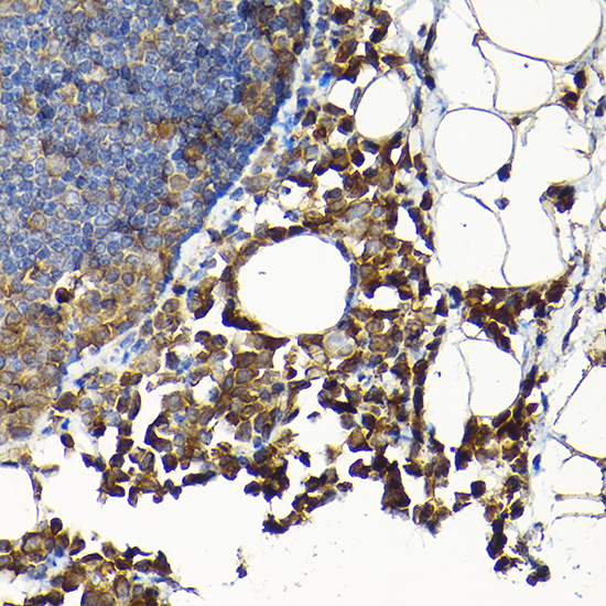 SCFD1 Rabbit polyclonal antibody
